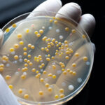 Hand mit medizinischem Handschuh hält eine Petrischale mit gelben und weißen runden Zellen (Mikrobiologie)